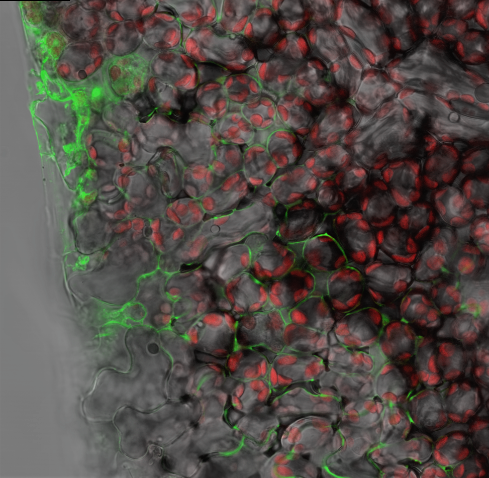 Das mikroskopische Bild zeigt Gewebe mit rot fluoreszierenden Chloroplasten sowie grün fluoreszierendem Protein, dass zwischen den Zellen sowie innerhalb einiger Zellen leuchtet.